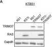 Fig.5.A showing Western Blotting in a Mus musculus (House mouse) sample from the publication: The TRIM37 variant rs57141087 contributes to triple-negative breast cancer outcomes in Black women.