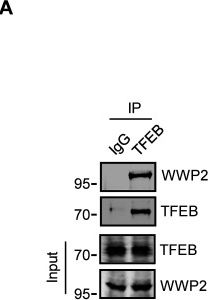 Fig.4.A showing Western Blotting from the publication: Lactylation stabilizes TFEB to elevate autophagy and lysosomal activity.