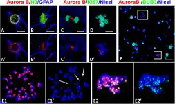 Fig.8.A,B,C,D,E showing Immunocytochemistry-immunofluorescence in a Rattus norvegicus (Rat) sample from the publication: Abnormal mitosis in reactive astrocytes.