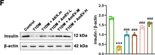 Fig.3.F showing Western Blotting in a Mus musculus (House mouse) sample from the publication: Extracellular vesicles from Akkermansia muciniphila protect streptozotocin-induced diabetic mice by regulating glucose homeostasis, oxidative stress, and immune tolerance.