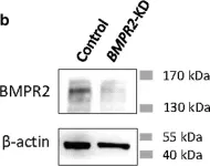 Fig.3.B showing Western Blotting in a Homo sapiens (Human) sample from the publication: Identification of a bone morphogenetic protein type 2 receptor neutralizing antibody.