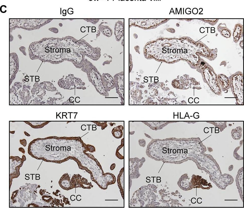 Fig.7.C showing Immunohistochemistry from the publication: Dysregulated BMP2 in the Placenta May Contribute to Early-Onset Preeclampsia by Regulating Human Trophoblast Expression of Extracellular Matrix and Adhesion Molecules.