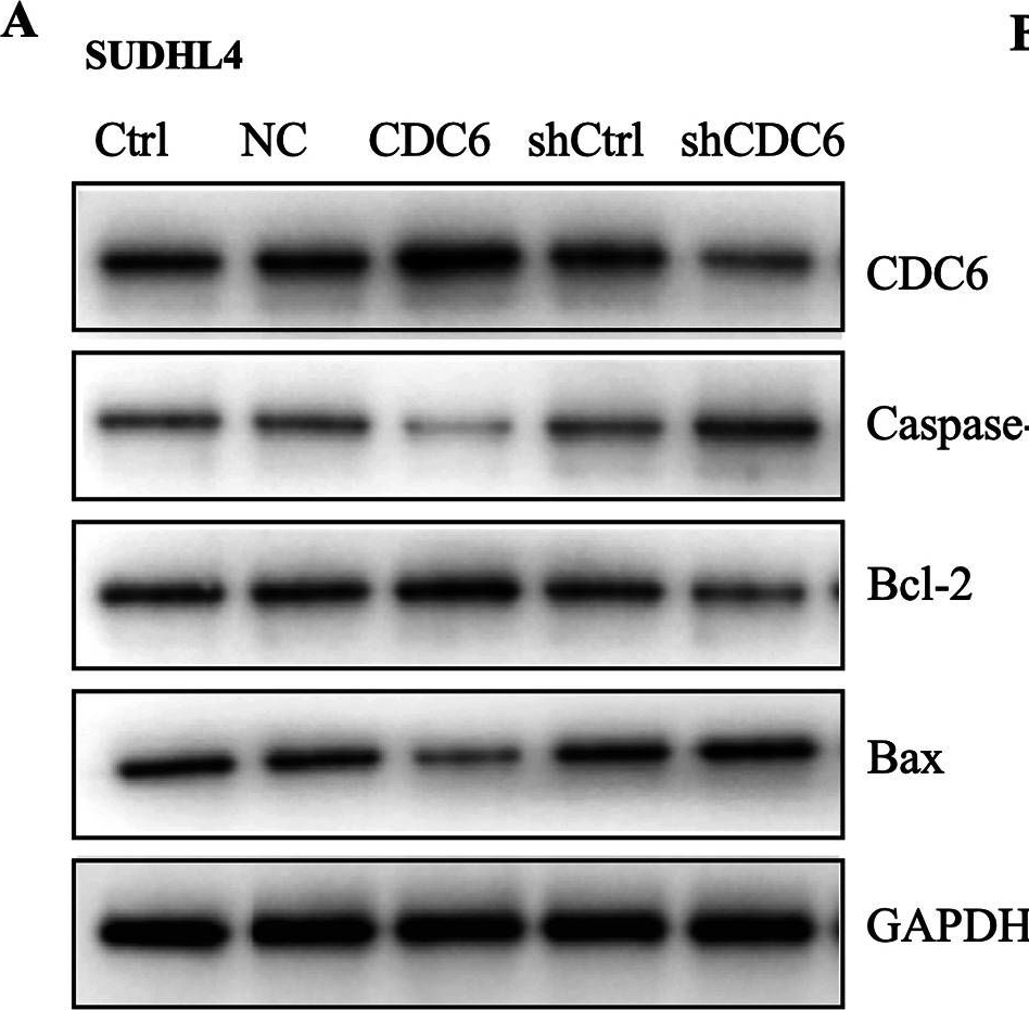 Fig.5.A showing Western Blotting in a Homo sapiens (Human) sample from the publication: CDC6, a key replication licensing factor, is overexpressed and confers poor prognosis in diffuse large B-cell lymphoma.