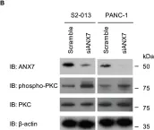 Fig.3.B showing Western Blotting in a Homo sapiens (Human) sample from the publication: BART inhibits pancreatic cancer cell invasion by PKCα inactivation through binding to ANX7.