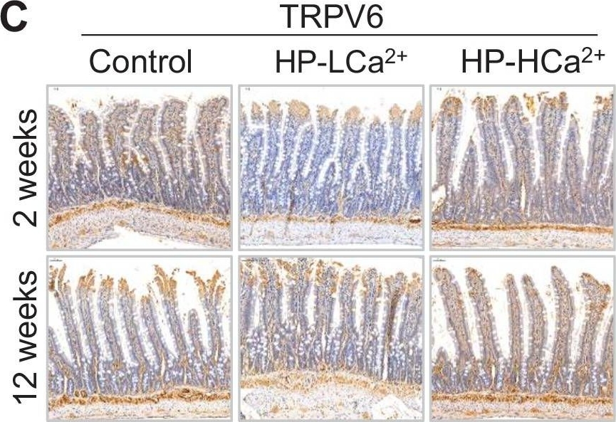 Fig.5.C showing Immunohistochemistry in a Rattus norvegicus (Rat) sample from the publication: High-phytate/low-calcium diet is a risk factor for crystal nephropathies, renal phosphate wasting, and bone loss.