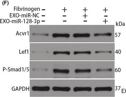 Fig.5.F showing Western Blotting from the publication: Exosomal miR-128-3p reversed fibrinogen-mediated inhibition of oligodendrocyte progenitor cell differentiation and remyelination after cerebral ischemia.