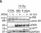 Fig.7.B showing Western Blotting in a Mus musculus (House mouse) sample from the publication: cGAS-STING drives ageing-related inflammation and neurodegeneration.