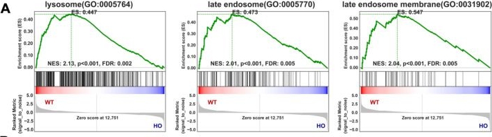 Fig.4.A from the publication: ATG5-FOXA3 Axis Contributes to Lysosomal Biogenesis and Auditory Function in Kölliker's Organ.