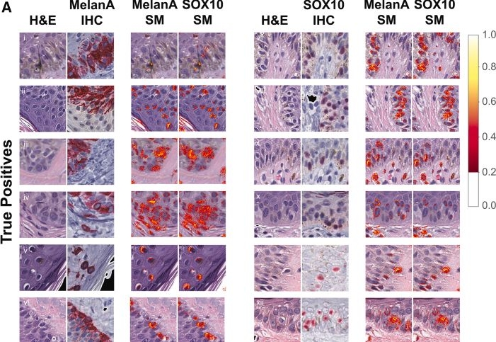 Fig.5.A showing Immunohistochemistry in a Mus musculus (House mouse) sample from the publication: Deep learning finds convergent melanocytic morphology despite noisy archival slides.