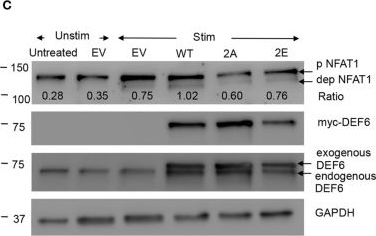 Fig.5.C showing Western Blotting in a Homo sapiens (Human) sample from the publication: Phosphoproteomics Reveals Regulatory T Cell-Mediated DEF6 Dephosphorylation That Affects Cytokine Expression in Human Conventional T Cells.