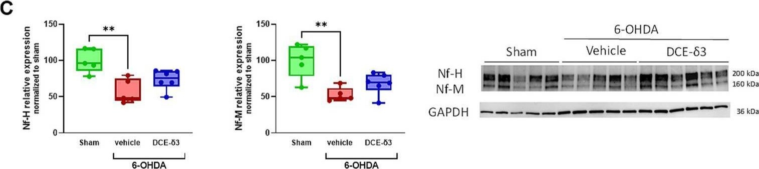 Fig.4.C showing Western Blotting from the publication: Intranasal delivery of dodecyl creatine ester alleviates motor deficits and increases dopamine levels in a 6-OHDA rat model of parkinsonism.