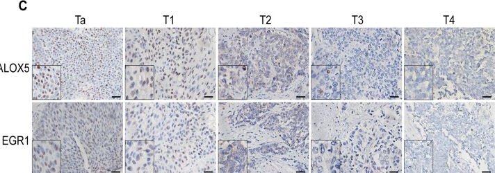 Fig.8.C showing Immunohistochemistry from the publication: ALOX5 deficiency contributes to bladder cancer progression by mediating ferroptosis escape.