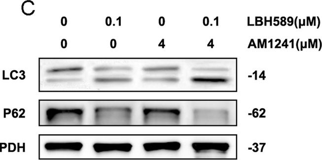 Fig.4.C showing Western Blotting from the publication: Panobinostat (LBH589) combined with AM1241 induces cervical cancer cell apoptosis through autophagy pathway.