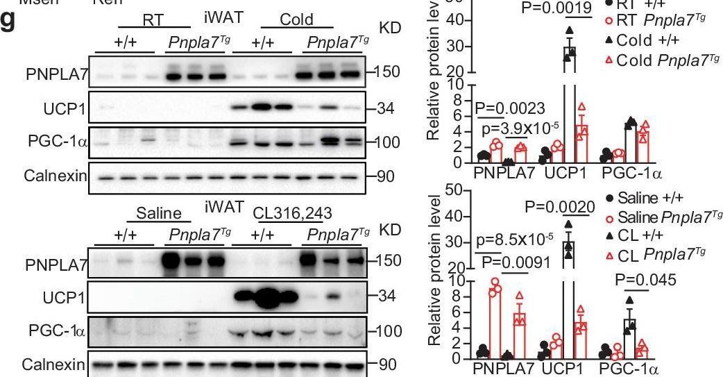 Fig.2.G showing Western Blotting from the publication: PNPLA7 mediates Parkin-mitochondrial recruitment in adipose tissue for mitophagy and inhibits browning.