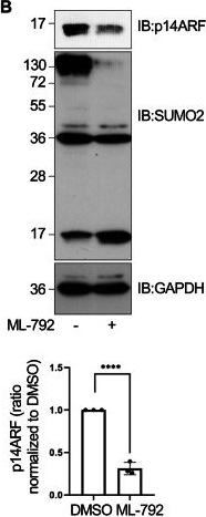 Fig.4.B showing Western Blotting from the publication: SUMOylation of the lysine-less tumor suppressor p14ARF counters ubiquitylation-dependent degradation.