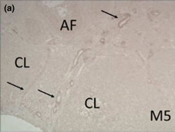Fig.3.A showing Immunohistochemistry from the publication: Muscarinic receptors in the rat ovary are involved in follicular development but not in steroid secretion.