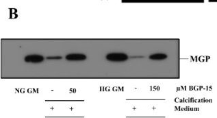 Fig.11.B showing Western Blotting from the publication: BGP-15 Inhibits Hyperglycemia-Aggravated VSMC Calcification Induced by High Phosphate.