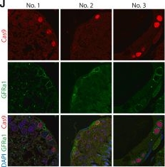 Fig.5.J showing Immunohistochemistry-immunofluorescence from the publication: Highly efficient and low-mosaicism piggyBac transgenesis platform for rapid founder phenotyping.