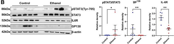 Fig.6.B showing Western Blotting in a Mus musculus (House mouse) sample from the publication: IL-6 trans-Signaling Regulates Neutrophilic Inflammation in Alcohol-Associated Hepatitis.