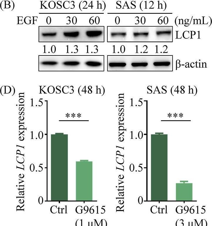 Fig.5.B showing Western Blotting in a Homo sapiens (Human) sample from the publication: LCP1 upregulation via EGFR signaling promotes oral cancer progression through the JAK2/STAT3/IL-1β axis.