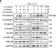 Fig.5.F showing Western Blotting from the publication: CDK4/6 and BET inhibitors synergistically suppress pancreatic tumor growth and epithelial-to-mesenchymal transition by regulating the GSK3β-mediated Wnt/β-catenin pathway.