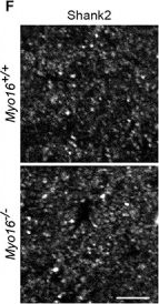 Fig.1.F showing Immunohistochemistry-immunofluorescence in a Mus musculus (House mouse) sample from the publication: Myosin XVI Regulates Actin Cytoskeleton Dynamics in Dendritic Spines of Purkinje Cells and Affects Presynaptic Organization.
