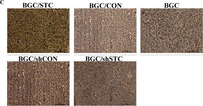 Fig.1.C showing Immunohistochemistry-paraffin in a Mus musculus (House mouse) sample from the publication: Stanniocalcin-1 promotes tumor angiogenesis through up-regulation of VEGF in gastric cancer cells.