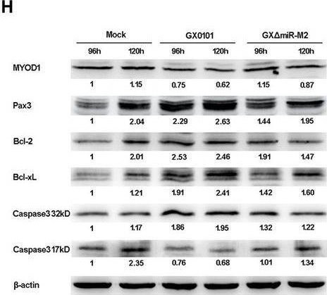 Fig.7.H showing Western Blotting from the publication: Marek's Disease Virus (Gallid alphaherpesvirus 2)-Encoded miR-M2-5p Simultaneously Promotes Cell Proliferation and Suppresses Apoptosis Through RBM24 and MYOD1-Mediated Signaling Pathways.