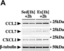 Fig.6.A showing Western Blotting from the publication: Essential roles of the cytokine oncostatin M in crosstalk between muscle fibers and immune cells in skeletal muscle after aerobic exercise.