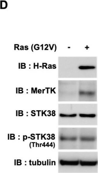 Fig.4.D showing Western Blotting in a Mus musculus (House mouse) sample from the publication: STK38 Kinase Promotes Cell Migration Induced by Oncogenic Ras via MerTK Activation.