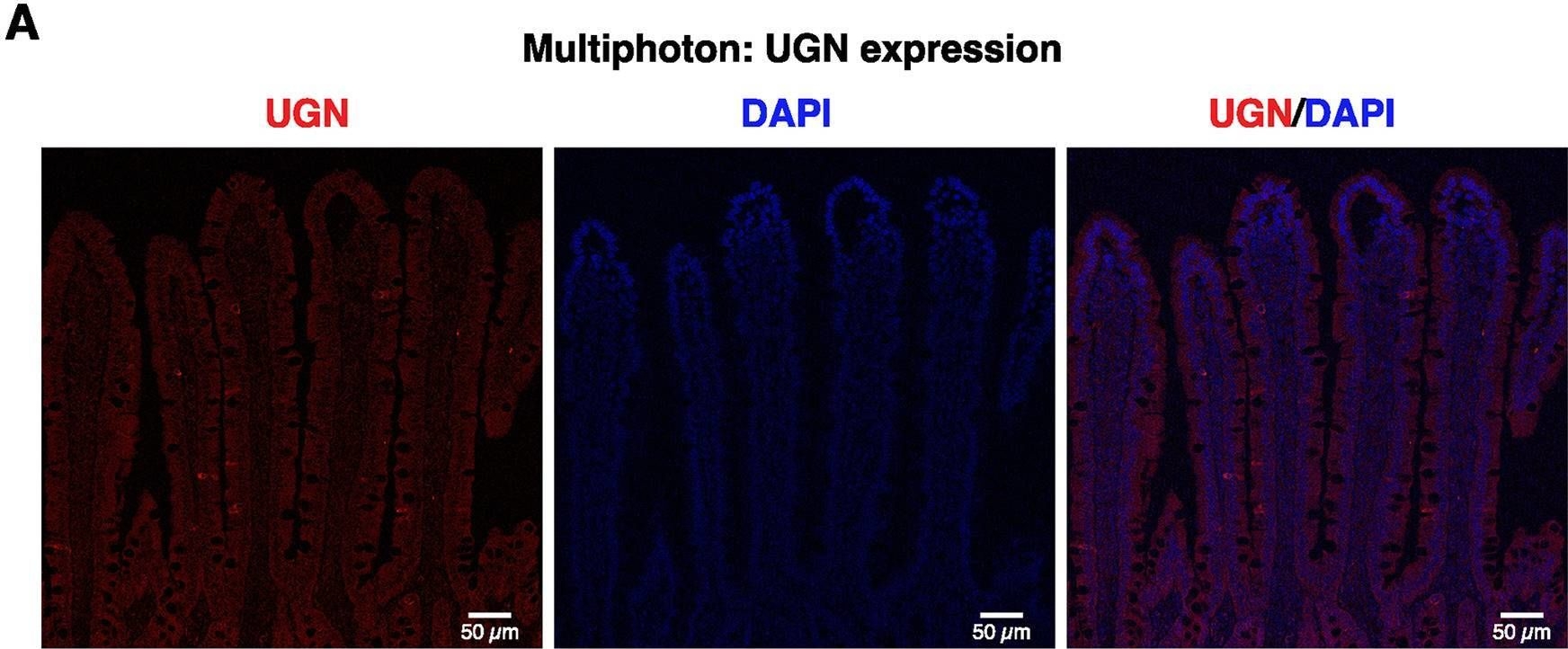 Fig.6.A showing Immunohistochemistry-immunofluorescence in a Rattus norvegicus (Rat) sample from the publication: Long-term excessive salt consumption alters villous and crypt morphology and the protein expression of uroguanylin, TRPV6 and PMCA1b in the rat small intestine.