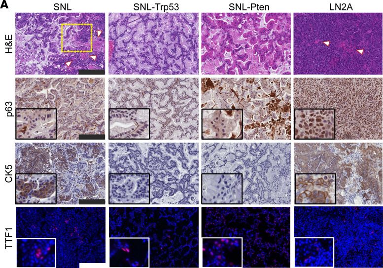 Fig.3.A showing Immunohistochemistry in a Mus musculus (House mouse) sample from the publication: Tumor suppressors in Sox2-mediated lung cancers promote distinct cell-intrinsic and immunologic remodeling.