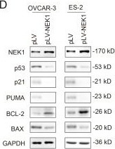 Fig.4.D showing Western Blotting from the publication: NEK1 Promotes Ovarian Cancer Progression via p53 Suppression While Enhancing Sensitivity to Genotoxic Therapy.