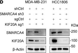 Fig.10.D showing Western Blotting in a Homo sapiens (Human) sample from the publication: Targeting kinesin family member 20A sensitizes stem-like triple-negative breast cancer cells to standard chemotherapy.