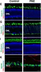 Fig.3.E showing Immunohistochemistry in a Mus musculus (House mouse) sample from the publication: In Utero Alcohol Exposure Impairs Retinal Angiogenesis and the Microvessel-Associated Positioning of Calretinin Interneurons.