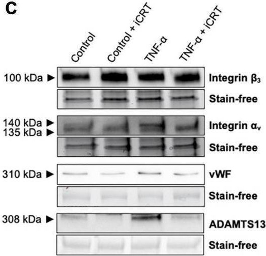 Fig.5.C showing Western Blotting in a Homo sapiens (Human) sample from the publication: Pro-inflammatory role of Wnt/β-catenin signaling in endothelial dysfunction.