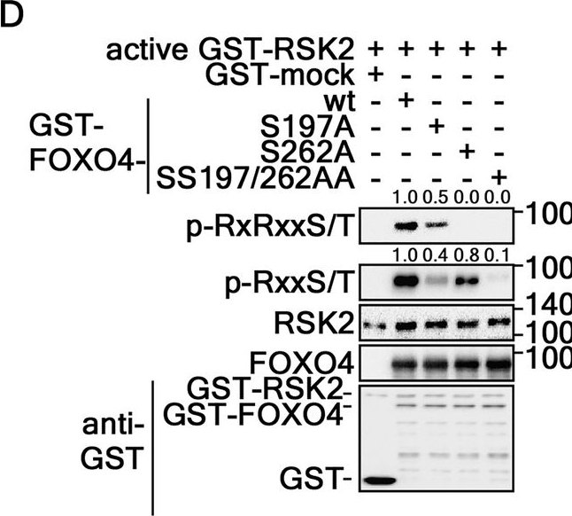 Fig.5.D showing Western Blotting from the publication: Ribosomal S6 kinase 2-forkhead box protein O4 signaling pathway plays an essential role in melanogenesis.