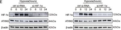 Fig.2.E showing Western Blotting in a Homo sapiens (Human) sample from the publication: Hypoxia promotes progression of cervical cancer by modulating the ATXN3-enhanced P53 stability or STAT5 phosphorylation.