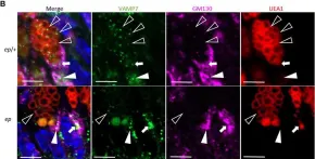 Fig.7.B showing Immunohistochemistry-immunofluorescence from the publication: HPS1 Regulates the Maturation of Large Dense Core Vesicles and Lysozyme Secretion in Paneth Cells.