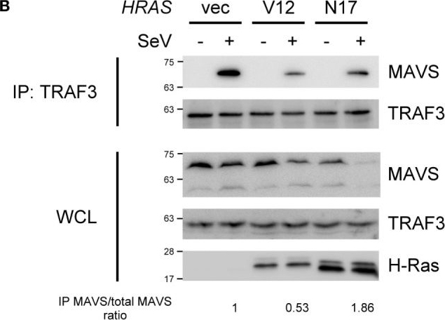 Fig.5.B showing Western Blotting in a Homo sapiens (Human) sample from the publication: H-Ras Exerts Opposing Effects on Type I Interferon Responses Depending on Its Activation Status.