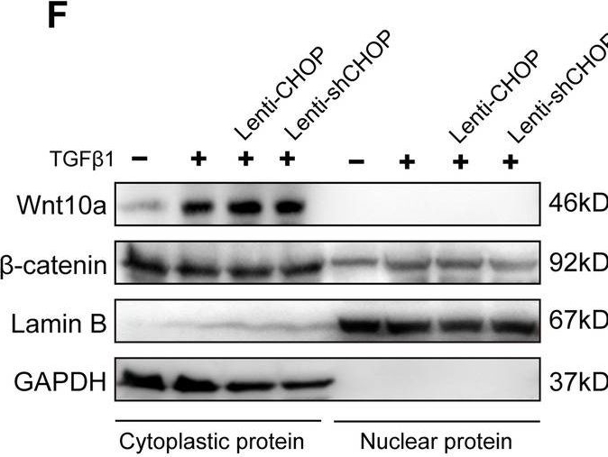 Fig.5.F showing Western Blotting from the publication: Endoplasmic reticulum stress modulates the fate of lung resident mesenchymal stem cell to myofibroblast via C/EBP homologous protein during pulmonary fibrosis.