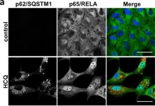 Fig.4.A showing Immunocytochemistry-immunofluorescence in a Homo sapiens (Human) sample from the publication: Autophagy inhibition-mediated epithelial-mesenchymal transition augments local myofibroblast differentiation in pulmonary fibrosis.