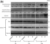 Fig.4.B showing Western Blotting from the publication: Cytotoxicity of the Sesquiterpene Lactone Spiciformin and Its Acetyl Derivative against the Human Leukemia Cell Lines U-937 and HL-60.