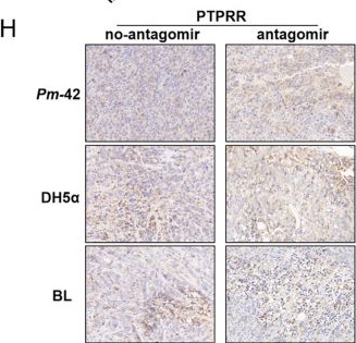 Fig.6.H showing Immunohistochemistry in a Mus musculus (House mouse) sample from the publication: Parvimonas micra activates the Ras/ERK/c-Fos pathway by upregulating miR-218-5p to promote colorectal cancer progression.