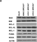 Fig.4.D showing Western Blotting in a Homo sapiens (Human) sample from the publication: Inactivation of BRCA2 in human cancer cells identifies a subset of tumors with enhanced sensitivity towards death receptor-mediated apoptosis.