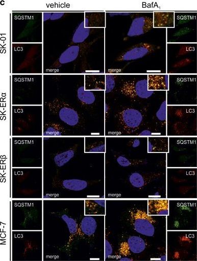 Estrogen receptor α regulates non-canonical autophagy that provides stress resistance to neuroblastoma and breast cancer cells and involves BAG3 function.