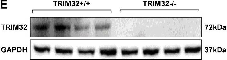 Fig.4.E showing Western Blotting in a Mus musculus (House mouse) sample from the publication: Tripartite motif 32 prevents pathological cardiac hypertrophy.