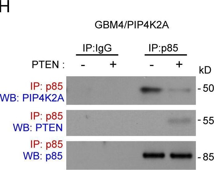 Fig.6.H showing Western Blotting from the publication: PIP4K2A as a negative regulator of PI3K in PTEN-deficient glioblastoma.