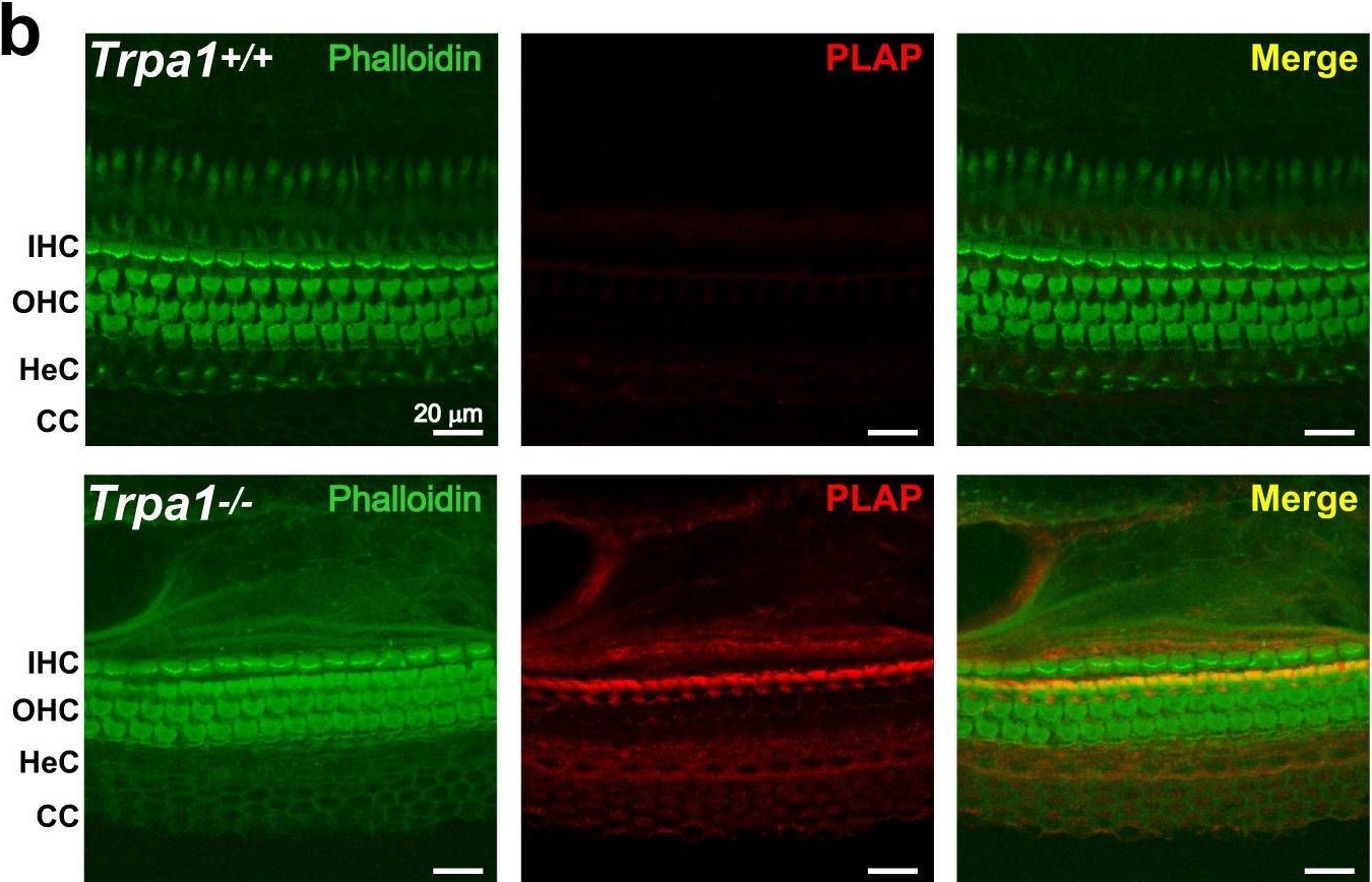 Fig.1.B showing Immunohistochemistry-immunofluorescence in a Mus musculus (House mouse) sample from the publication: TRPA1 activation in non-sensory supporting cells contributes to regulation of cochlear sensitivity after acoustic trauma.