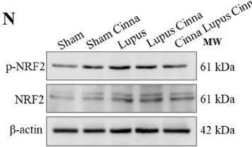 Fig.1.N showing Western Blotting from the publication: Antioxidant and Anti-Apoptotic Neuroprotective Effects of Cinnamon in Imiquimod-Induced Lupus.